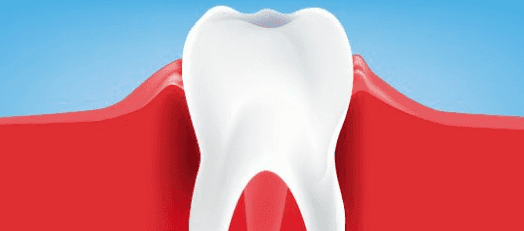 Tooth Diagram